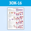 Плакат «Что такое лейкемия?» (ЗОЖ-16, пластик 2 мм, A1, 1 лист)